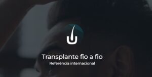 Transplante Capilar Perto de Mim - Transplante fio a fio!